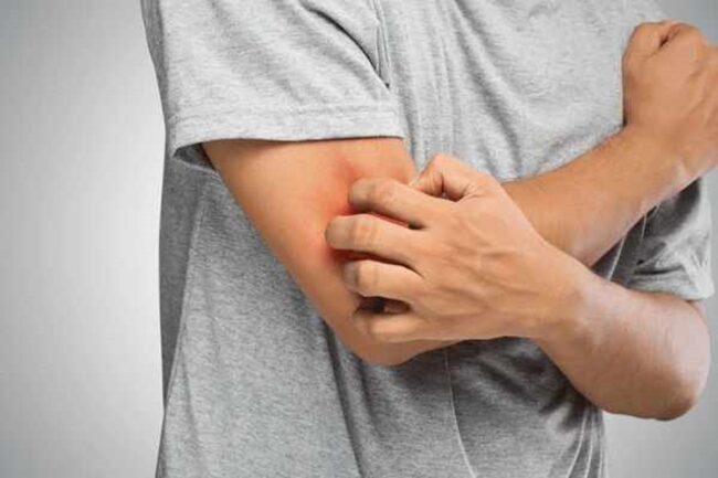 20 Left & Right Elbow Itching Meanings & Superstitions