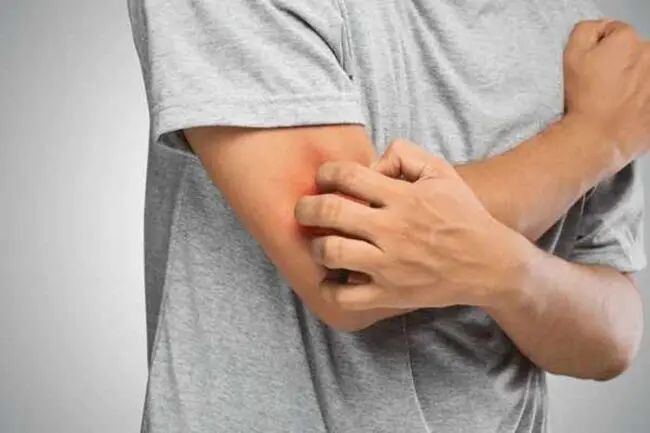 20 Left & Right Elbow Itching Meanings & Superstitions